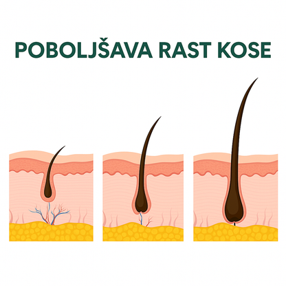 Serum za rast kose – jača korijen i povećava gustinu - BESPLATNA POŠTARINA