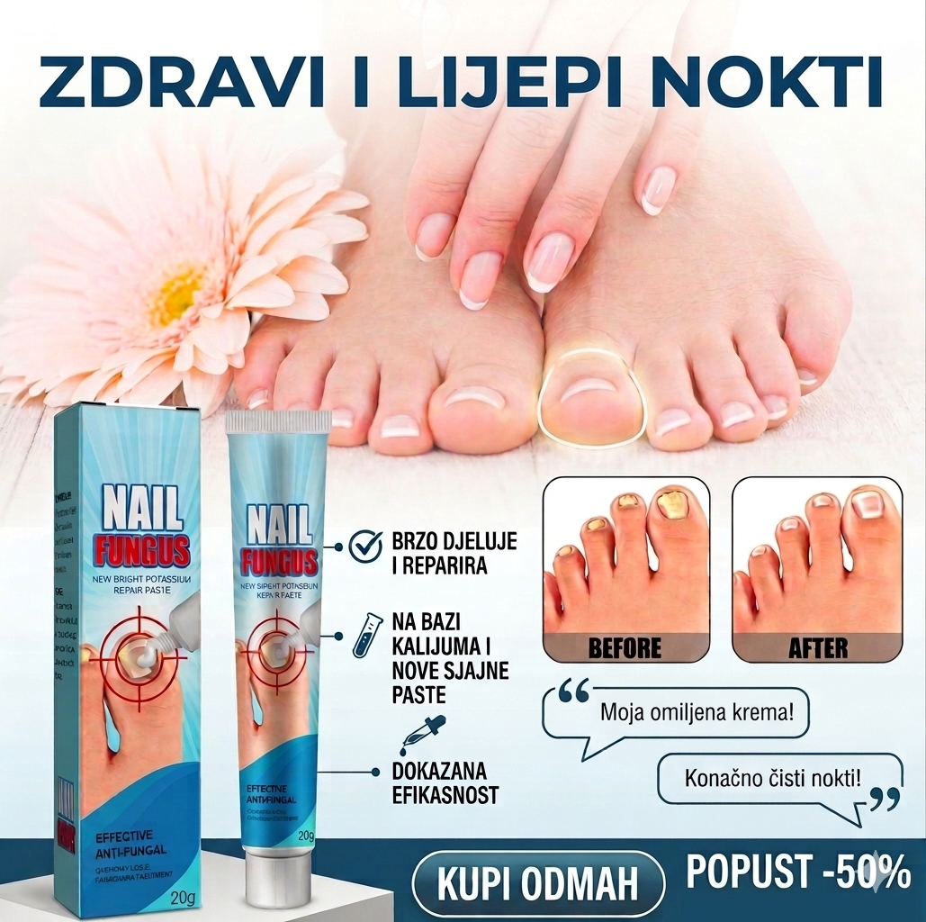 Krema protiv gljivičnih infekcija - BESPLATNA POŠTARINA