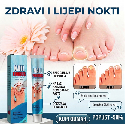 Krema protiv gljivičnih infekcija - BESPLATNA POŠTARINA