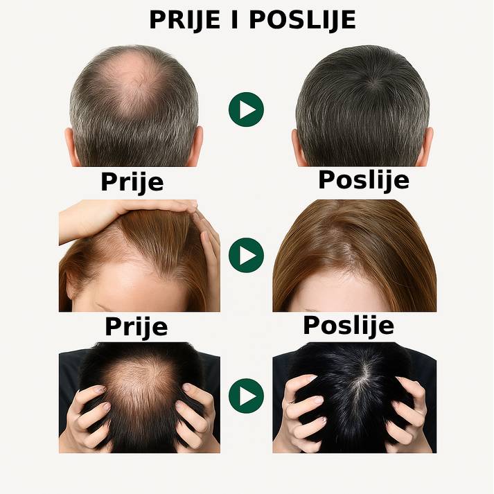 Serum za rast kose – jača korijen i povećava gustinu - BESPLATNA POŠTARINA