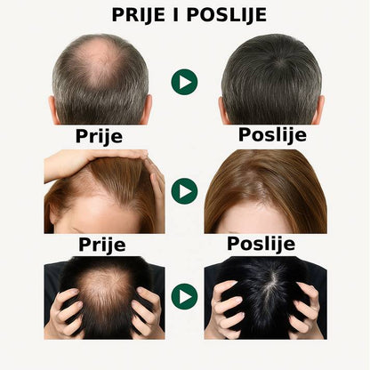 Serum za rast kose – jača korijen i povećava gustinu - BESPLATNA POŠTARINA