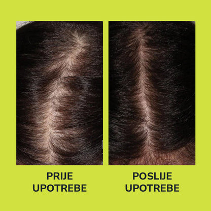 Serum za rast kose – jača korijen i povećava gustinu - BESPLATNA POŠTARINA